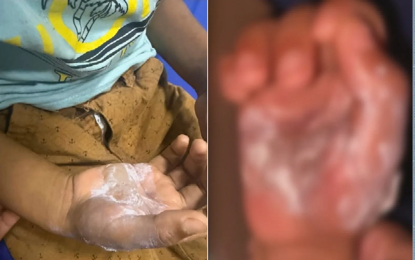 Mulher é presa em Cidade Ocidental suspeita de ferir filho com colher quente