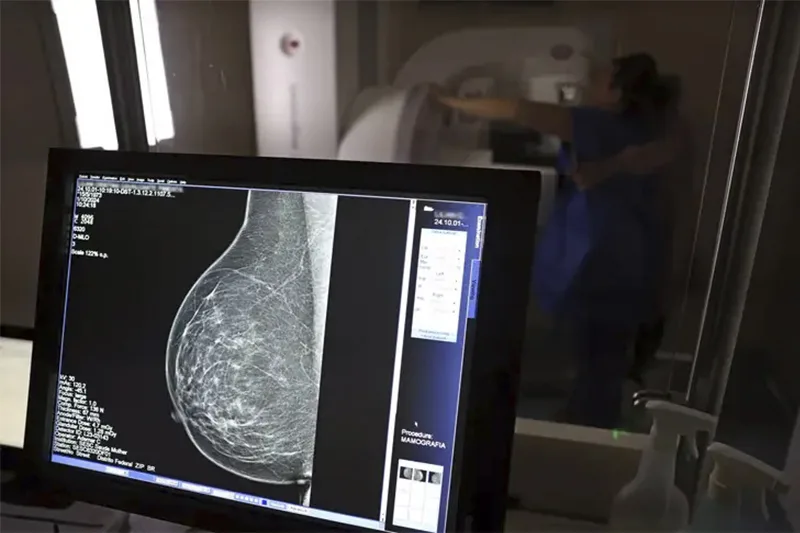 Anvisa amplia indicações do Trodelvy para câncer de mama triplo-negativo