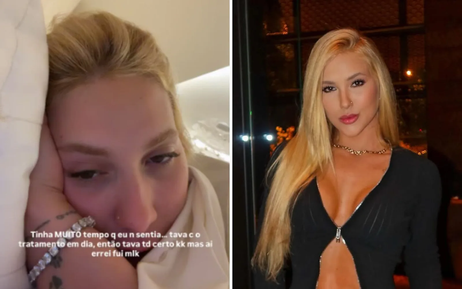 Virginia Fonseca relata nova crise de enxaqueca após atraso no tratamento