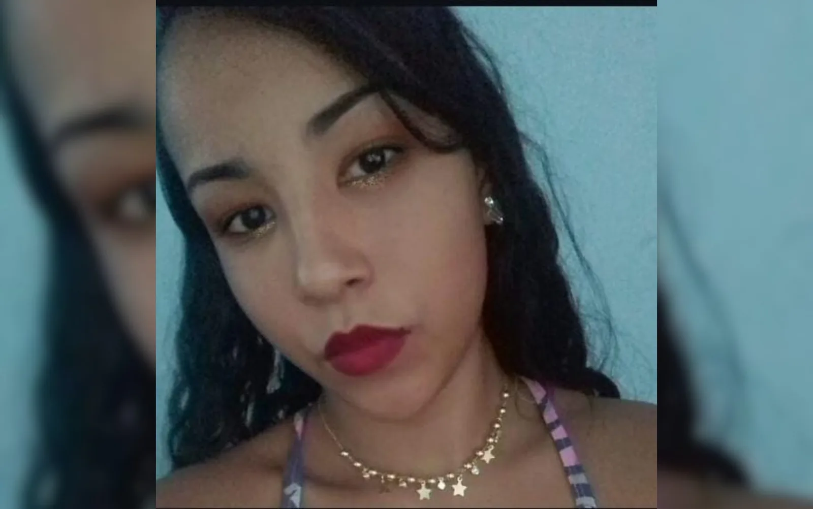 Jovem morre após sete dias internada com queimaduras em Goiânia