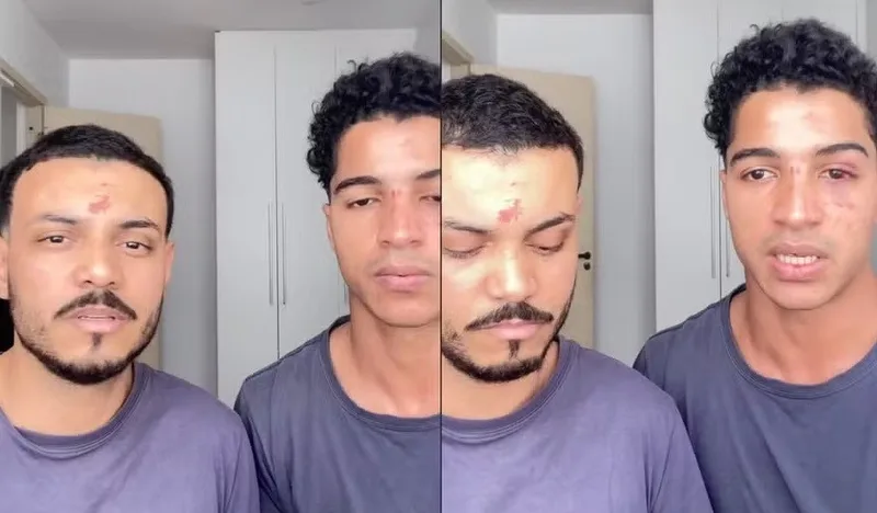Casal denuncia agressão e homofobia após festa na Reitoria da UFRJ