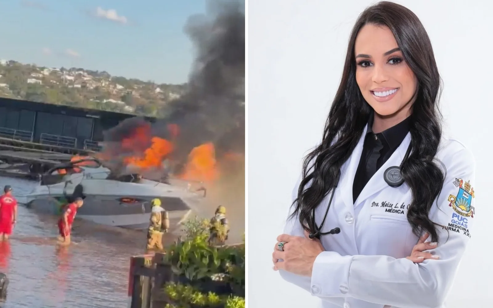 Médica queimada em explosão de lancha deixa UTI após quinto procedimento